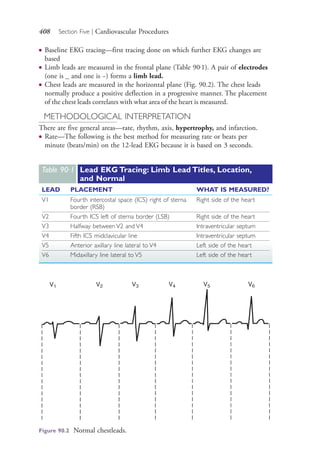408 Section Five | Cardiovascular Procedures
● Baseline EKG tracing—first tracing done on which further EKG changes are
based
● Limb leads are measured in the frontal plane (Table 90.1). A pair of electrodes
(one is _ and one is −) forms a limb lead.
● Chest leads are measured in the horizontal plane (Fig. 90.2). The chest leads
normally produce a positive deflection in a progressive manner. The placement
of the chest leads correlates with what area of the heart is measured.
METHODOLOGICAL INTERPRETATION
There are five general areas—rate, rhythm, axis, hypertrophy, and infarction.
● Rate—The following is the best method for measuring rate or beats per
minute (beats/min) on the 12-lead EKG because it is based on 3 seconds.
Table 90·1 Lead EKG Tracing: Limb Lead Titles, Location,
and Normal
LEAD PLACEMENT WHAT IS MEASURED?
V1 Fourth intercostal space (ICS) right of sterna
border (RSB)
Right side of the heart
V2 Fourth ICS left of sterna border (LSB) Right side of the heart
V3 Halfway between V2 and V4 Intraventricular septum
V4 Fifth ICS midclavicular line Intraventricular septum
V5 Anterior axillary line lateral to V4 Left side of the heart
V6 Midaxillary line lateral to V5 Left side of the heart
Figure 90.2 Normal chestleads.
4206_Chapter 5_0403-0462.indd 4084206_Chapter 5_0403-0462.indd 408 12/25/2014 4:47:03 PM12/25/2014 4:47:03 PM
Process CyanProcess CyanProcess MagentaProcess MagentaProcess YellowProcess YellowProcess BlackProcess Black
 