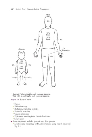 28 Section One | Dermatological Procedures
Figure 7.1 Rule of nines.
Adults
Children
* Subtract 1% from head for each year over age one.
† Add 1/2% to each leg for each year over age one.
8%
18%
Front
18%
Front
18%
Back
18%
Back
9%
9%9%
14%† 14%†
18%*
9%
18% 18%
1%
Perineum
●
Flames
●
Flash electricity
●
Radiation, including sunlight
●
Hot solid materials
●
Caustic chemicals
●
Explosions resulting from chemical mixtures
●
Severe cold
● Burn assessment includes systemic and skin systems
●
Location and percentage of BSA involvement using rule of nines (see
Fig. 7.1)
4206_Chapter 1_0001-0120.indd 284206_Chapter 1_0001-0120.indd 28 12/24/2014 2:01:15 PM12/24/2014 2:01:15 PM
Process CyanProcess CyanProcess MagentaProcess MagentaProcess YellowProcess YellowProcess BlackProcess Black
 