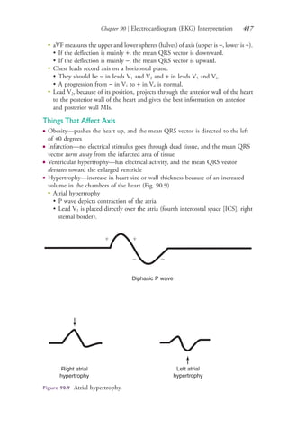 Chapter 90 | Electrocardiogram (EKG) Interpretation 417
●
aVF measures the upper and lower spheres (halves) of axis (upper is −, lower is +).
• If the deflection is mainly +, the mean QRS vector is downward.
• If the deflection is mainly −, the mean QRS vector is upward.
●
Chest leads record axis on a horizontal plane.
• They should be − in leads V1 and V2 and + in leads V5 and V6.
• A progression from − in V1 to + in V6 is normal.
●
Lead V2, because of its position, projects through the anterior wall of the heart
to the posterior wall of the heart and gives the best information on anterior
and posterior wall MIs.
Things That Affect Axis
● Obesity—pushes the heart up, and the mean QRS vector is directed to the left
of +0 degrees
● Infarction—no electrical stimulus goes through dead tissue, and the mean QRS
vector turns away from the infarcted area of tissue
● Ventricular hypertrophy—has electrical activity, and the mean QRS vector
deviates toward the enlarged ventricle
● Hypertrophy—increase in heart size or wall thickness because of an increased
volume in the chambers of the heart (Fig. 90.9)
●
Atrial hypertrophy
• P wave depicts contraction of the atria.
• Lead V1 is placed directly over the atria (fourth intercostal space [ICS], right
sternal border).
Figure 90.9 Atrial hypertrophy.
4206_Chapter 5_.indd 4174206_Chapter 5_.indd 417 12/24/2014 2:31:00 PM12/24/2014 2:31:00 PM
Process CyanProcess CyanProcess MagentaProcess MagentaProcess YellowProcess YellowProcess BlackProcess Black
 