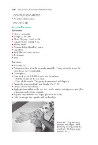 440 Section Five | Cardiovascular Procedures
CONTRAINDICATIONS
● No collateral circulation
PROCEDURE
Arterial Puncture
Equipment
● Gloves—nonsterile
● Syringe—3 to 5 mL
● 23- to 25-gauge, 1-inch needle
● Heparin (1,000 U/mL), 1 mL
● Alcohol swabs
● Povidone-iodine (Betadine) swabs
● Cup of ice
● Small block of rubber or latex
● 2 × 2 gauze
● Tape
Procedure
● Select the site.
● Position the client with the site easily accessible. If using the radial artery, the
wrist should be hyperextended.
● Put on gloves.
● Draw up 1 mL of 1:1,000 heparin into the syringe.
●
Pull the plunger all the way back.
●
Expel all the heparin. The syringe is now coated with heparin.
● Palpate the artery proximally and distally (Fig. 95.3).
● Cleanse the site with alcohol.
● Apply povidone-iodine to the area in a circular motion, starting where you plan
to puncture and working outward.
● Trap the artery between two fingers placed on each side.
● Hold the syringe like a pencil, with the bevel up.
Figure 95.3 Trap the artery
between two fingers. After
preparing the site, insert the
needle at a 90-degree angle
into the artery.
4206_Chapter 5_.indd 4404206_Chapter 5_.indd 440 12/24/2014 2:31:01 PM12/24/2014 2:31:01 PM
Process CyanProcess CyanProcess MagentaProcess MagentaProcess YellowProcess YellowProcess BlackProcess Black
 