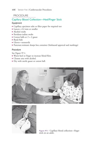 446 Section Five | Cardiovascular Procedures
PROCEDURE
Capillary Blood Collection—Heel/Finger Stick
Equipment
● Capillary specimen tube or filter paper for required test
● Lancet—2.4 mm or smaller
● Alcohol swabs
● Povidone-iodine swabs
● Cotton balls or 2 × 2 gauze
● Band-Aids
● Gloves—nonsterile
● Puncture-resistant sharps box container (biohazard approval and markings)
Procedure
See Figure 97.1.
● Warm heel or finger to increase blood flow.
● Cleanse area with alcohol.
● Dry with sterile gauze or cotton ball.
Figure 97.1 Capillary blood collection—finger
stick on an adult.
4206_Chapter 5_.indd 4464206_Chapter 5_.indd 446 12/24/2014 2:31:02 PM12/24/2014 2:31:02 PM
Process CyanProcess CyanProcess MagentaProcess MagentaProcess YellowProcess YellowProcess BlackProcess Black
 