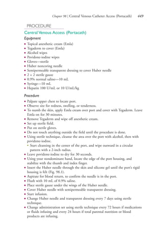 Chapter 98 | Central Venous Catheter Access (Portacath) 449
PROCEDURE
Central Venous Access (Portacath)
Equipment
● Topical anesthetic cream (Emla)
● Tegaderm to cover (Emla)
● Alcohol wipes
● Povidone-iodine wipes
● Gloves—sterile
● Huber noncoring needle
● Semipermeable transparent dressing to cover Huber needle
● 2 × 2 sterile gauze
● 0.9% normal saline—10 mL
● Syringe—10 mL
● Heparin 100 U/mL or 10 U/mL/kg
Procedure
● Palpate upper chest to locate port.
● Observe site for redness, swelling, or tenderness.
● To numb the skin, apply Emla cream over port and cover with Tegaderm. Leave
Emla on for 30 minutes.
● Remove Tegaderm and wipe off anesthetic cream.
● Set up sterile field.
● Put on sterile gloves.
● Do not touch anything outside the field until the procedure is done.
● Using sterile technique, cleanse the area over the port with alcohol, then with
povidone-iodine.
●
Start cleansing in the center of the port, and wipe outward in a circular
pattern with a 2-inch radius.
● Leave povidone-iodine to dry for 30 seconds.
● Using your nondominant hand, locate the edge of the port housing, and
stabilize with the thumb and index finger.
● Insert the Huber needle through the skin and silicone gel until the port’s rigid
housing is felt (Fig. 98.1).
● Aspirate for blood return, to confirm the needle is in the port.
● Flush with 10 mL of 0.9% saline.
● Place sterile gauze under the wings of the Huber needle.
● Cover Huber needle with semipermeable transparent dressing.
● Start infusion.
● Change Huber needle and transparent dressing every 7 days using sterile
technique.
● Change administration set using sterile technique every 72 hours if medications
or fluids infusing and every 24 hours if total parental nutrition or blood
products are infusing.
4206_Chapter 5_.indd 4494206_Chapter 5_.indd 449 12/24/2014 2:31:02 PM12/24/2014 2:31:02 PM
Process CyanProcess CyanProcess MagentaProcess MagentaProcess YellowProcess YellowProcess BlackProcess Black
 