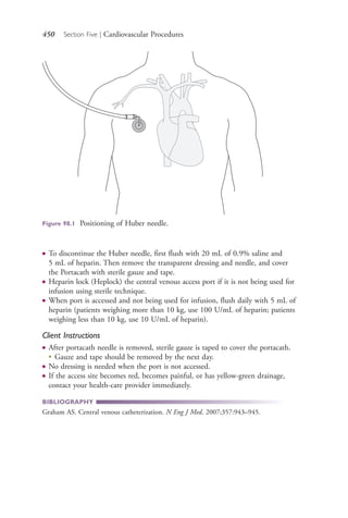 450 Section Five | Cardiovascular Procedures
● To discontinue the Huber needle, first flush with 20 mL of 0.9% saline and
5 mL of heparin. Then remove the transparent dressing and needle, and cover
the Portacath with sterile gauze and tape.
● Heparin lock (Heplock) the central venous access port if it is not being used for
infusion using sterile technique.
● When port is accessed and not being used for infusion, flush daily with 5 mL of
heparin (patients weighing more than 10 kg, use 100 U/mL of heparin; patients
weighing less than 10 kg, use 10 U/mL of heparin).
Client Instructions
● After portacath needle is removed, sterile gauze is taped to cover the portacath.
●
Gauze and tape should be removed by the next day.
● No dressing is needed when the port is not accessed.
● If the access site becomes red, becomes painful, or has yellow-green drainage,
contact your health-care provider immediately.
BIBLIOGRAPHY
Graham AS. Central venous catheterization. N Eng J Med. 2007;357:943–945.
Figure 98.1 Positioning of Huber needle.
4206_Chapter 5_.indd 4504206_Chapter 5_.indd 450 12/24/2014 2:31:02 PM12/24/2014 2:31:02 PM
Process CyanProcess CyanProcess MagentaProcess MagentaProcess YellowProcess YellowProcess BlackProcess Black
 