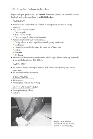 454 Section Five | Cardiovascular Procedures
higher collagen production, less eschar formation (eschar can diminish wound
healing), and an increased rate of epithelialization.
OVERVIEW
● Venous ulcers constitute 67% to 90% of all leg ulcers (usually in elderly
women).
● The Unna’s boot is used to
●
Decrease pain
●
Assist venous return
●
Decrease superficial venous distention
● Venous insufficiency symptoms include
●
Pitting edema in lower legs that responds poorly to diuretics
●
Tenderness
●
Hemosiderin—reddish-brown discoloration of lower calf
●
Scaling
●
Pruritus
●
Erythema
● Venous ulceration usually occurs at the medial aspect of the lower leg, especially
at the medial malleolus (Fig. 100.1).
RATIONALE
● To increase wound healing in patients with venous insufficiency and venous
stasis ulcers
● To promote ankle stabilization
INDICATIONS
● Venous ulcers
● Ankle sprain with severe swelling
CONTRAINDICATIONS
● Acute pulmonary edema
● Cellulitis
Figure 100.1 Venous
ulceration on the medial
aspect of the lower leg.
4206_Chapter 5_.indd 4544206_Chapter 5_.indd 454 12/24/2014 2:31:02 PM12/24/2014 2:31:02 PM
Process CyanProcess CyanProcess MagentaProcess MagentaProcess YellowProcess YellowProcess BlackProcess Black
 