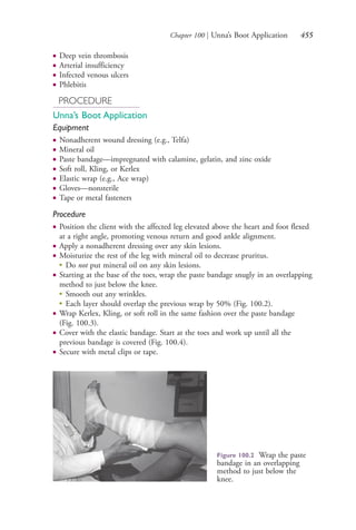 Chapter 100 | Unna’s Boot Application 455
● Deep vein thrombosis
● Arterial insufficiency
● Infected venous ulcers
● Phlebitis
PROCEDURE
Unna’s Boot Application
Equipment
● Nonadherent wound dressing (e.g., Telfa)
● Mineral oil
● Paste bandage—impregnated with calamine, gelatin, and zinc oxide
● Soft roll, Kling, or Kerlex
● Elastic wrap (e.g., Ace wrap)
● Gloves—nonsterile
● Tape or metal fasteners
Procedure
● Position the client with the affected leg elevated above the heart and foot flexed
at a right angle, promoting venous return and good ankle alignment.
● Apply a nonadherent dressing over any skin lesions.
● Moisturize the rest of the leg with mineral oil to decrease pruritus.
●
Do not put mineral oil on any skin lesions.
● Starting at the base of the toes, wrap the paste bandage snugly in an overlapping
method to just below the knee.
●
Smooth out any wrinkles.
●
Each layer should overlap the previous wrap by 50% (Fig. 100.2).
● Wrap Kerlex, Kling, or soft roll in the same fashion over the paste bandage
(Fig. 100.3).
● Cover with the elastic bandage. Start at the toes and work up until all the
previous bandage is covered (Fig. 100.4).
● Secure with metal clips or tape.
Figure 100.2 Wrap the paste
bandage in an overlapping
method to just below the
knee.
4206_Chapter 5_.indd 4554206_Chapter 5_.indd 455 12/24/2014 2:31:02 PM12/24/2014 2:31:02 PM
Process CyanProcess CyanProcess MagentaProcess MagentaProcess YellowProcess YellowProcess BlackProcess Black
 
