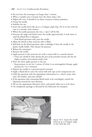 460 Section Five | Cardiovascular Procedures
● Do not leave the tourniquet on longer than 1 minute.
● When a suitable vein is located, have the client make a fist.
● Palpate the vein. It should be an elastic sensation without pulsation.
● Uncap the needle.
● Stabilize the site.
● Insert the needle bevel side up at a 15-degree angle (Fig. 101.2) in line with the
vein in a smooth, clean motion.
● When the needle penetrates the vein, a “give” will be felt.
● Decrease the angle and slowly insert the needle approximately ⅛ inch more or
until the blood flow is adequate.
●
Push blood specimen tube onto the needle.
● Allow the blood to flow until the tube is filled.
● Pull back on the blood specimen tube to dislodge it from the needle in the
plastic needle holder. This releases the pressure.
● Release the tourniquet.
● Remove the needle.
● Apply pressure to the puncture site with a cotton ball in a smooth motion.
●
Great care should be taken during this part of the procedure because this has the
highest incidence of accidental needle sticks.
● Have the client apply pressure to the site.
●
Keep pressure to site for 1 minute (if client is on anticoagulant therapy, apply
pressure for 3 to 5 minutes).
● Deposit the needle in a puncture-proof container.
● Apply a Band-Aid or cover the cotton ball with tape at the venipuncture site.
● Label the specimen with the appropriate information (i.e., client’s name, date,
time, ID number, and your initials).
● If the specimen tube containing blood needs to be centrifuged, consult the
laboratory manual for time duration.
● Fill out the appropriate laboratory form, and specify what test is to be done.
● On completion, package as directed by the laboratory for transport.
Figure 101.2 Insert the needle
bevel up at a 15-degree angle
in line with the vein.
4206_Chapter 5_.indd 4604206_Chapter 5_.indd 460 12/24/2014 2:31:03 PM12/24/2014 2:31:03 PM
Process CyanProcess CyanProcess MagentaProcess MagentaProcess YellowProcess YellowProcess BlackProcess Black
 