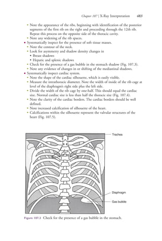 Chapter 107 | X-Ray Interpretation 483
●
Note the appearance of the ribs, beginning with identification of the posterior
segments of the first rib on the right and proceeding through the 12th rib.
Repeat this process on the opposite side of the thoracic cavity.
●
Note any widening of the rib spaces.
● Systematically inspect for the presence of soft tissue masses.
●
Note the contour of the neck.
●
Look for asymmetry and shadow density changes in
• Breast shadows
• Hepatic and splenic shadows
●
Check for the presence of a gas bubble in the stomach shadow (Fig. 107.3).
●
Note any evidence of changes in or shifting of the mediastinal shadows.
● Systematically inspect cardiac system.
●
Note the shape of the cardiac silhouette, which is easily visible.
●
Measure the intrathoracic diameter. Note the width of inside of the rib cage at
level of the diaphragm’s right side plus the left side.
●
Divide the width of the rib cage by one-half. This should equal the cardiac
size. Normal cardiac size is less than half the thoracic size (Fig. 107.4).
●
Note the clarity of the cardiac borders. The cardiac borders should be well
defined.
●
Note increased calcification of silhouette of the heart.
●
Calcifications within the silhouette represent the valvular structures of the
heart (Fig. 107.5).
Trachea
Diaphragm
Gas bubble
Figure 107.3 Check for the presence of a gas bubble in the stomach.
4206_Chapter 6_.indd 4834206_Chapter 6_.indd 483 12/24/2014 2:30:45 PM12/24/2014 2:30:45 PM
Process CyanProcess CyanProcess MagentaProcess MagentaProcess YellowProcess YellowProcess BlackProcess Black
 