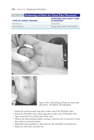 490 Section Six | Respiratory Procedures
Table 108∙2 Positioning of Client for Chest Tube Placement
TYPE OF CHEST TRAUMA
POSITION FOR CHEST TUBE
PLACEMENT
Hemothorax Orthopneic
Pneumothorax Supine, high Fowler’s, semi-Fowler’s
Figure 108.2 Positioning of client for chest tube
placement. (A) Supine; (B) orthopneic.
A
B
●
Attach the urinary/ostomy bag tube to blue end of the Heimlich valve.
●
Attach the Heimlich valve connecting tube to other end of Heimlich valve.
●
Tape connection site at both ends of the valve.
●
Cleanse site with povidone-iodine starting at insertion site in concentric circles
three times in outward motion.
●
Administer local anesthetic to skin between ribs identified as insertion site.
●
Drape the chest tube insertion site.
4206_Chapter 6_.indd 4904206_Chapter 6_.indd 490 12/24/2014 2:30:45 PM12/24/2014 2:30:45 PM
Process CyanProcess CyanProcess MagentaProcess MagentaProcess YellowProcess YellowProcess BlackProcess Black
 