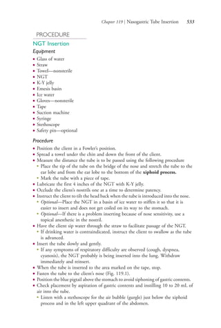 Chapter 119 | Nasogastric Tube Insertion 533
PROCEDURE
NGT Insertion
Equipment
● Glass of water
● Straw
● Towel—nonsterile
● NGT
● K-Y jelly
● Emesis basin
● Ice water
● Gloves—nonsterile
● Tape
● Suction machine
● Syringe
● Stethoscope
● Safety pin—optional
Procedure
● Position the client in a Fowler’s position.
● Spread a towel under the chin and down the front of the client.
● Measure the distance the tube is to be passed using the following procedure
●
Place the tip of the tube on the bridge of the nose and stretch the tube to the
ear lobe and from the ear lobe to the bottom of the xiphoid process.
●
Mark the tube with a piece of tape.
● Lubricate the first 4 inches of the NGT with K-Y jelly.
● Occlude the client’s nostrils one at a time to determine patency.
● Instruct the client to tilt the head back when the tube is introduced into the nose.
●
Optional—Place the NGT in a basin of ice water to stiffen it so that it is
easier to insert and does not get coiled on its way to the stomach.
●
Optional—If there is a problem inserting because of nose sensitivity, use a
topical anesthetic in the nostril.
● Have the client sip water through the straw to facilitate passage of the NGT.
●
If drinking water is contraindicated, instruct the client to swallow as the tube
is advanced.
● Insert the tube slowly and gently.
●
If any symptoms of respiratory difficulty are observed (cough, dyspnea,
cyanosis), the NGT probably is being inserted into the lung. Withdraw
immediately and reinsert.
● When the tube is inserted to the area marked on the tape, stop.
● Fasten the tube to the client’s nose (Fig. 119.1).
● Position the blue pigtail above the stomach to avoid siphoning of gastric contents.
● Check placement by aspiration of gastric contents and instilling 10 to 20 mL of
air into the tube.
●
Listen with a stethoscope for the air bubble (gurgle) just below the xiphoid
process and in the left upper quadrant of the abdomen.
4206_Chapter 7_.indd 5334206_Chapter 7_.indd 533 12/24/2014 2:30:32 PM12/24/2014 2:30:32 PM
Process CyanProcess CyanProcess MagentaProcess MagentaProcess YellowProcess YellowProcess BlackProcess Black
 