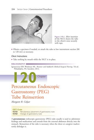 534 Section Seven | Gastrointestinal Procedures
Figure 119.1 After insertion
of the NGT, fasten the tube
to the client’s nose securely
with tape.
● Obtain a specimen if needed, or attach the tube to low intermittent suction (80
to 120 mL) as necessary.
Client Instructions
● Take nothing by mouth while the NGT is in place.
BIBLIOGRAPHY
Ignatavicius DD, Workman ML. Brunner and Suddarth’s Medical-Surgical Nursing. 7th ed.
Philadelphia, PA: Saunders; 2012.
120Chapter
Percutaneous Endoscopic
Gastrostomy (PEG)
Tube Reinsertion
Margaret R. Colyar
CPT Code
43750 Percutaneous placement of gastrostomy tube
43760 Change of gastrostomy tube
A percutaneous endoscopic gastrostomy (PEG) tube usually is used to administer
feedings and medications and extends from the external abdomen directly into the
stomach. Reinsertion of the tube is necessary when the client or caregiver inadver-
tently dislodges it.
4206_Chapter 7_.indd 5344206_Chapter 7_.indd 534 12/24/2014 2:30:32 PM12/24/2014 2:30:32 PM
Process CyanProcess CyanProcess MagentaProcess MagentaProcess YellowProcess YellowProcess BlackProcess Black
 