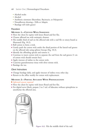 44 Section One | Dermatological Procedures
●
Alcohol swabs
●
Alcohol
●
Antibiotic ointment (Bactroban, Bacitracin, or Polysporin)
●
Nonadherent dressing—Telfa or Adaptic
●
Bandage roll (tube gauze)
Procedure
METHOD 1—COTTON WICK INSERTION
● Have the client lie supine with knees flexed and feet flat.
● Cleanse affected toe with antiseptic cleanser.
● File middle third of nail on the affected side with a nail file or emery board as
illustrated (Fig. 10.2).
● Roll cotton to form a wick.
● Gently push the cotton wick under the distal portion of the lateral nail groove
on the affected side using splinter forceps (Fig. 10.3).
● Identify the offending spicule and remove it.
● Continue to insert cotton wick to separate the nail from the nail groove (1 cm
of cotton wick should remain free).
● Apply tincture of iodine to the cotton wick.
● Cauterize granulomatous tissue with silver nitrate stick.
● Bandage the toe.
Client Instructions
● Change bandage daily, and apply tincture of iodine every other day.
● Return to the office weekly for cotton wick replacement.
METHOD 2—PARTIAL AVULSION WITH PHENOLIZATION
◗ Informed consent required
● Have the client lie supine with knees flexed and feet flat.
● For digital nerve block, prepare 3 to 5 mL of lidocaine without epinephrine to
anesthetize the affected area.
Figure 10.2 File the middle third of the nail.
4206_Chapter 1_0001-0120.indd 444206_Chapter 1_0001-0120.indd 44 12/24/2014 2:01:16 PM12/24/2014 2:01:16 PM
Process CyanProcess CyanProcess MagentaProcess MagentaProcess YellowProcess YellowProcess BlackProcess Black
 