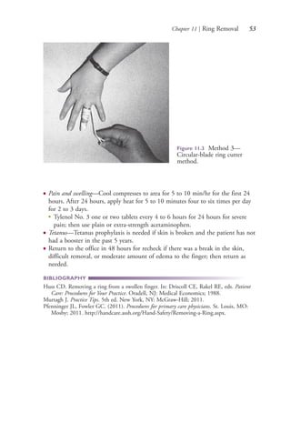 Chapter 11 | Ring Removal 53
● Pain and swelling—Cool compresses to area for 5 to 10 min/hr for the first 24
hours. After 24 hours, apply heat for 5 to 10 minutes four to six times per day
for 2 to 3 days.
●
Tylenol No. 3 one or two tablets every 4 to 6 hours for 24 hours for severe
pain; then use plain or extra-strength acetaminophen.
● Tetanus—Tetanus prophylaxis is needed if skin is broken and the patient has not
had a booster in the past 5 years.
● Return to the office in 48 hours for recheck if there was a break in the skin,
difficult removal, or moderate amount of edema to the finger; then return as
needed.
BIBLIOGRAPHY
Huss CD. Removing a ring from a swollen finger. In: Driscoll CE, Rakel RE, eds. Patient
Care: Procedures for Your Practice. Oradell, NJ: Medical Economics; 1988.
Murtagh J. Practice Tips. 5th ed. New York, NY: McGraw-Hill; 2011.
Pfenninger JL, Fowler GC. (2011). Procedures for primary care physicians. St. Louis, MO:
Mosby; 2011. http://handcare.assh.org/Hand-Safety/Removing-a-Ring.aspx.
Figure 11.3 Method 3—
Circular-blade ring cutter
method.
4206_Chapter 1_0001-0120.indd 534206_Chapter 1_0001-0120.indd 53 12/24/2014 2:01:17 PM12/24/2014 2:01:17 PM
Process CyanProcess CyanProcess MagentaProcess MagentaProcess YellowProcess YellowProcess BlackProcess Black
 