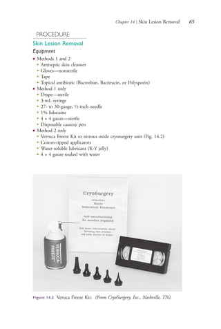Chapter 14 | Skin Lesion Removal 65
PROCEDURE
Skin Lesion Removal
Equipment
● Methods 1 and 2
●
Antiseptic skin cleanser
●
Gloves—nonsterile
●
Tape
●
Topical antibiotic (Bactroban, Bacitracin, or Polysporin)
● Method 1 only
●
Drape—sterile
●
3-mL syringe
●
27- to 30-gauge, ½-inch needle
●
1% lidocaine
●
4 × 4 gauze—sterile
●
Disposable cautery pen
● Method 2 only
●
Verruca Freeze Kit or nitrous oxide cryosurgery unit (Fig. 14.2)
●
Cotton-tipped applicators
● Water-soluble lubricant (K-Y jelly)
● 4 × 4 gauze soaked with water
Figure 14.2 Veruca Freeze Kit. (From CryoSurgery, Inc., Nashville, TN).
4206_Chapter 1_0001-0120.indd 654206_Chapter 1_0001-0120.indd 65 12/24/2014 2:01:17 PM12/24/2014 2:01:17 PM
Process CyanProcess CyanProcess MagentaProcess MagentaProcess YellowProcess YellowProcess BlackProcess Black
 