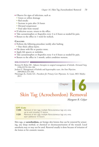 Chapter 16 | Skin Tag (Acrochordon) Removal 73
● Observe for signs of infections, such as
●
Green or yellow drainage
●
Red streaks
●
Increase in pain after 24 hours
●
Elevated temperature
●
Foul odor from wound
● If infection occurs, return to the office.
● Take acetaminophen or ibuprofen every 4 to 6 hours as needed for pain.
● Return to the office in 1 week for recheck.
CALLUSES
● Perform the following procedure weekly after bathing
●
Pare thick callous layers.
● File down with file or pumice stone.
● Apply felt spacers or moleskin.
● Take acetaminophen or ibuprofen every 4 to 6 hours as needed for pain.
● Return to the office in 1 month, unless condition worsens.
BIBLIOGRAPHY
Berman B, Bieley HC. Adjunct therapies to surgical management of keloids. Dermatol Surg.
1996;22(79):126–130.
Juckett G. Management of keloids and hypertrophic scars. Am Fam Physician.
2009;80(3):253–260.
Pfenninger JL, Fowler GC. Procedures for Primary Care Physicians. St. Louis, MO: Mosby;
2011.
Chapter
16Skin Tag (Acrochordon) Removal
Margaret R. Colyar
CPT Code
11200 Removal of skin tags, multiple fibrocutaneous tags any area;
up to and including 15 lesions
11201 Removal of skin tags, multiple fibrocutaneous tags any area;
each additional 10 lesions
Skin tags, or acrochordons, are benign skin lesions that can be removed by scissor-
ing, any sharp method, or chemical or electrocauterization of the wound. Local
anesthesia may or may not be used. Removal usually is done because of irritation of
the lesion or for cosmetic reasons.
4206_Chapter 1_0001-0120.indd 734206_Chapter 1_0001-0120.indd 73 12/24/2014 2:01:18 PM12/24/2014 2:01:18 PM
Process CyanProcess CyanProcess MagentaProcess MagentaProcess YellowProcess YellowProcess BlackProcess Black
 