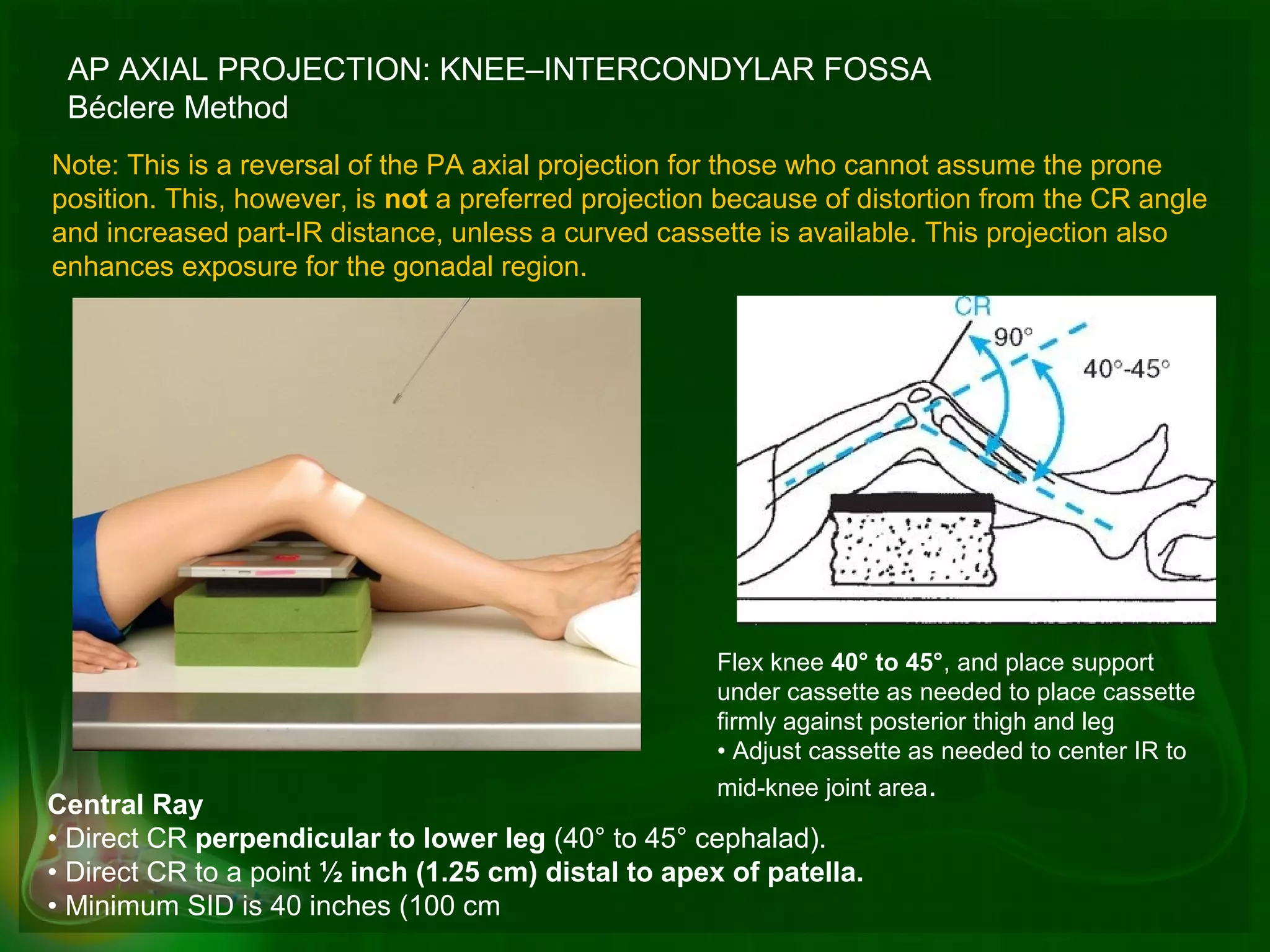 Advanced radiographic positions for the lower extremities | PPT