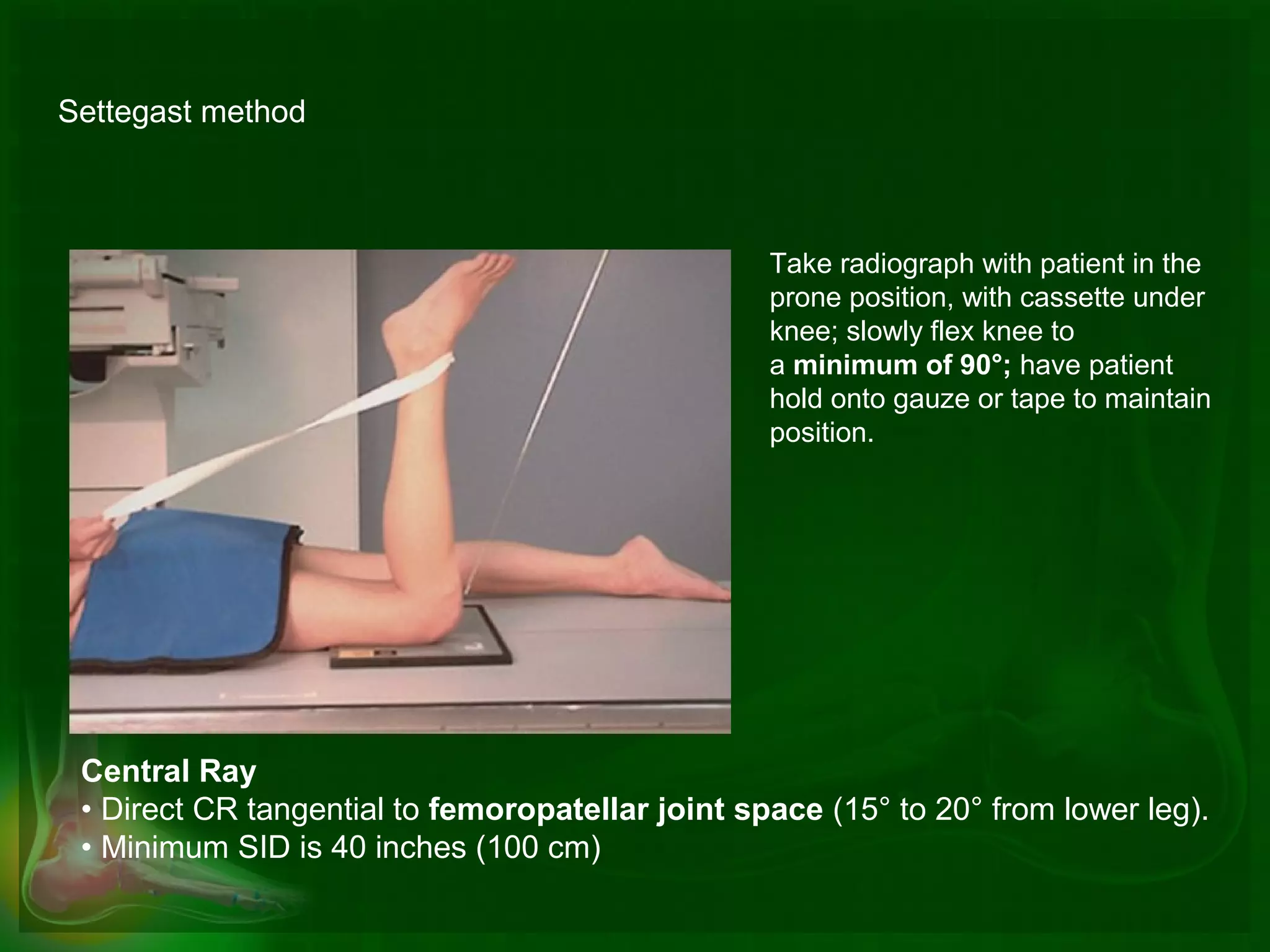 Advanced radiographic positions for the lower extremities | PPT