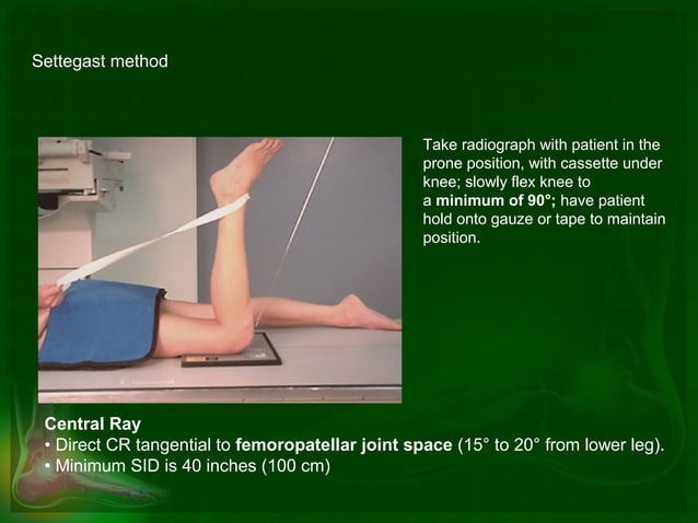 Lilienfeld Method Advanced radiographic positions for the lower extremities | PPT