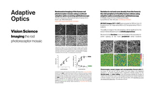 Advanced Retinal Imaging | PDF