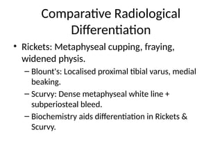 Advanced Radiological Review of Paediatric Rickets, Blount's Disease ...