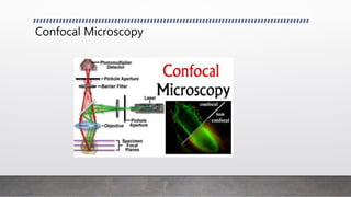 Confocal Microscopy
 