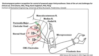 Electromyogram pattern recognition for control of powered upper-limb prostheses: State of the art and challenges for
clinical use. Erik Scheme, MSc, PEng; Kevin Englehart, PhD, PEng*
Institute of Biomedical Engineering, University of New Brunswick, Fredericton, Canada
JRRD Volume 48, Number 6, 2011 Pages 643–660
 