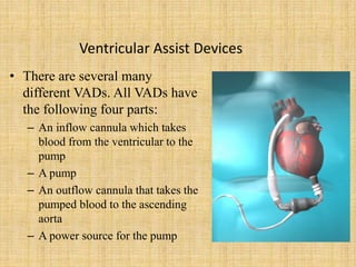 Ventricular Assist Devices
• There are several many
different VADs. All VADs have
the following four parts:
– An inflow cannula which takes
blood from the ventricular to the
pump
– A pump
– An outflow cannula that takes the
pumped blood to the ascending
aorta
– A power source for the pump
 