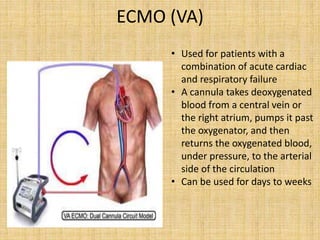 ECMO (VA)
• Used for patients with a
combination of acute cardiac
and respiratory failure
• A cannula takes deoxygenated
blood from a central vein or
the right atrium, pumps it past
the oxygenator, and then
returns the oxygenated blood,
under pressure, to the arterial
side of the circulation
• Can be used for days to weeks
 