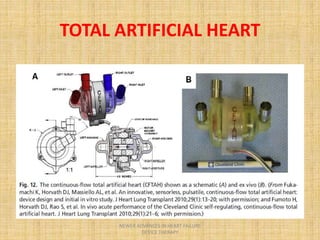 TOTAL ARTIFICIAL HEART
NEWER ADVANCES IN HEART FAILURE
DEVICE THERAPY
 