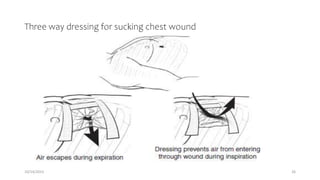 Three way dressing for sucking chest wound
10/14/2023 26
 