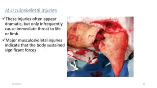 Musculoskeletal Injuries
These injuries often appear
dramatic, but only infrequently
cause immediate threat to life
or limb.
Major musculoskeletal injuries
indicate that the body sustained
significant forces
43
10/14/2023
 