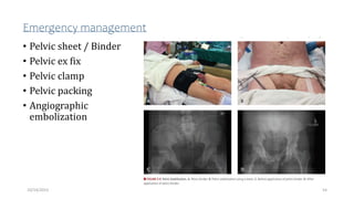 Emergency management
• Pelvic sheet / Binder
• Pelvic ex fix
• Pelvic clamp
• Pelvic packing
• Angiographic
embolization
54
10/14/2023
 