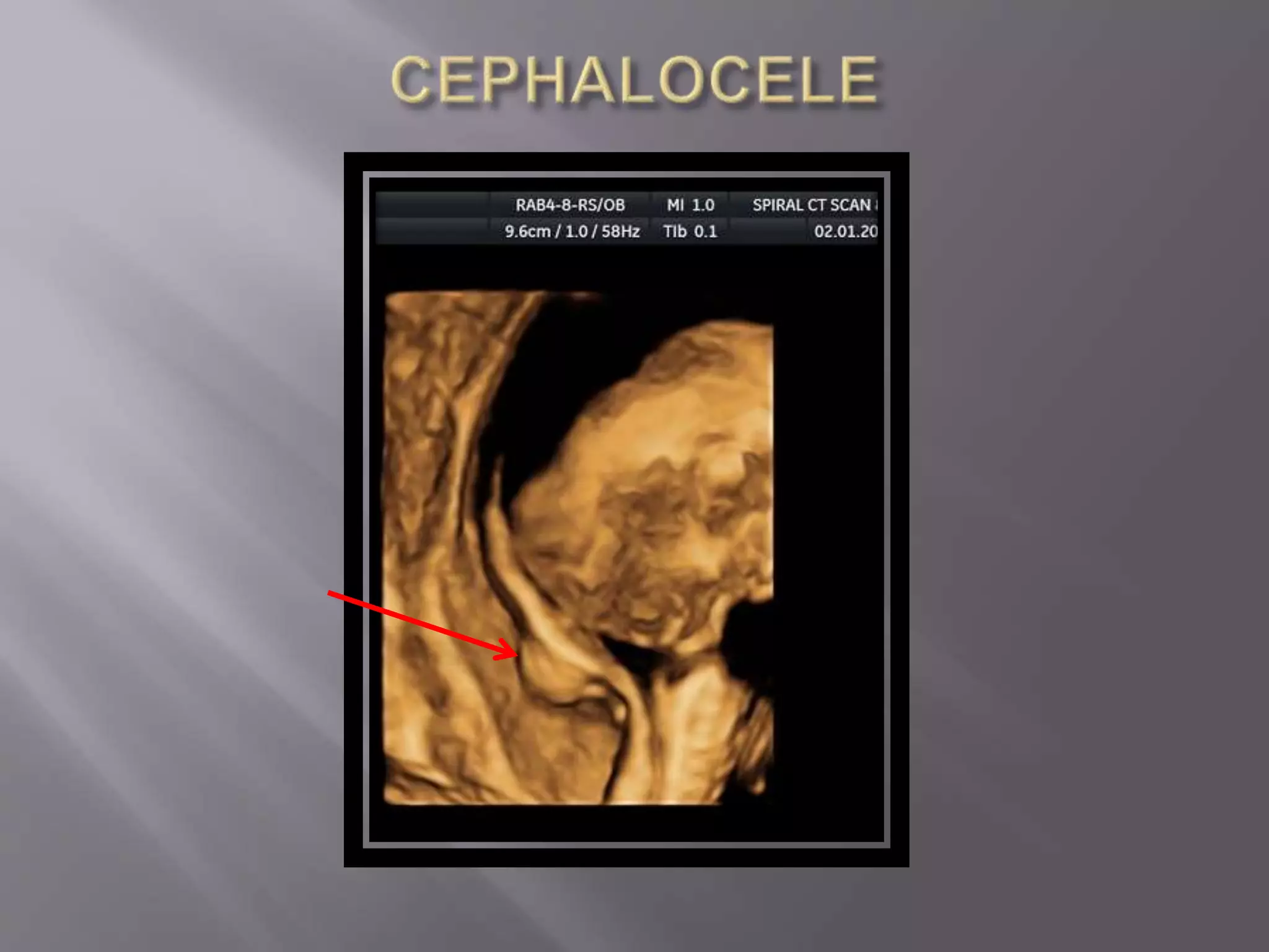 Advanced usg lounge 3 d image gallery