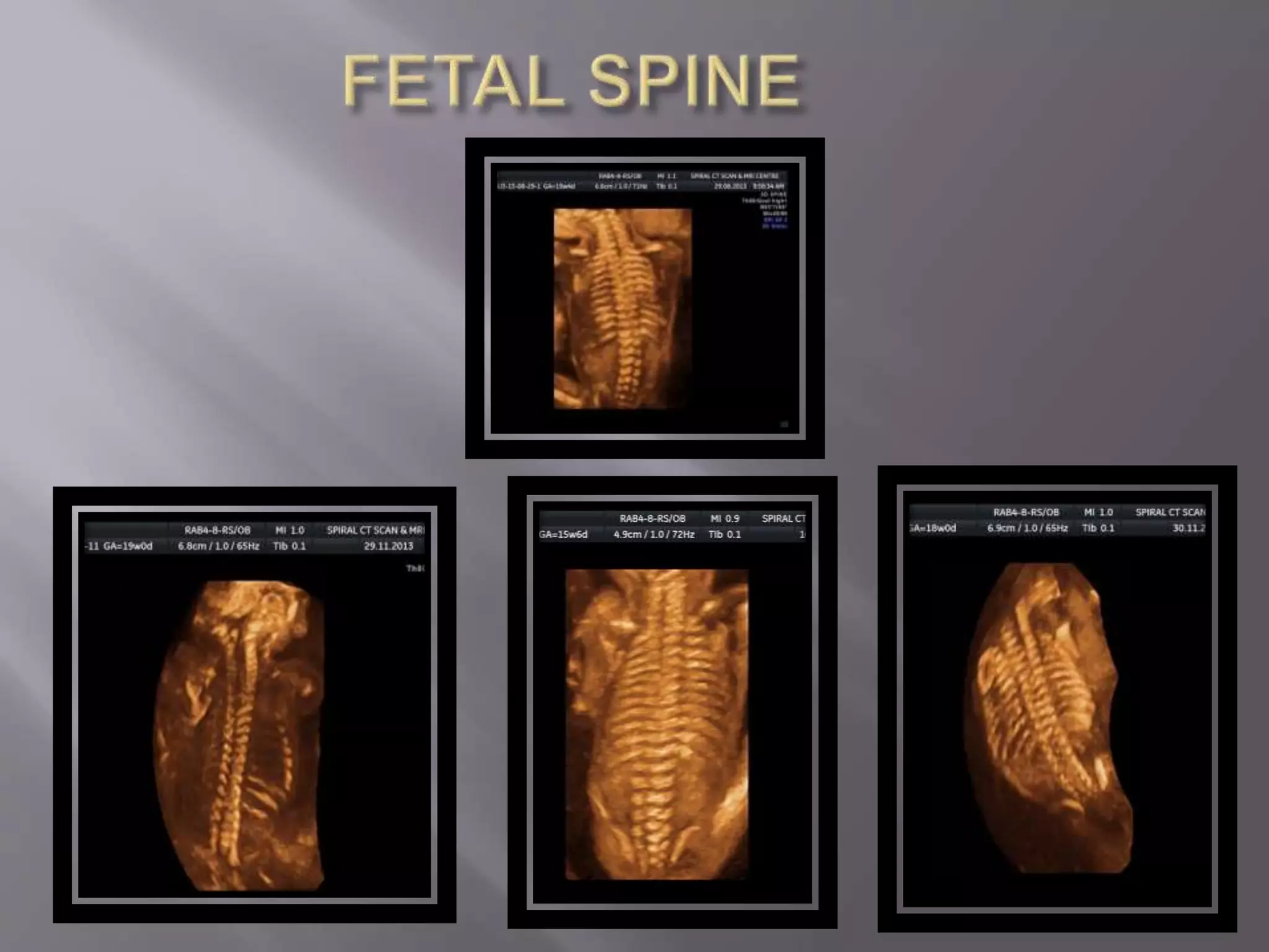 Advanced usg lounge 3 d image gallery