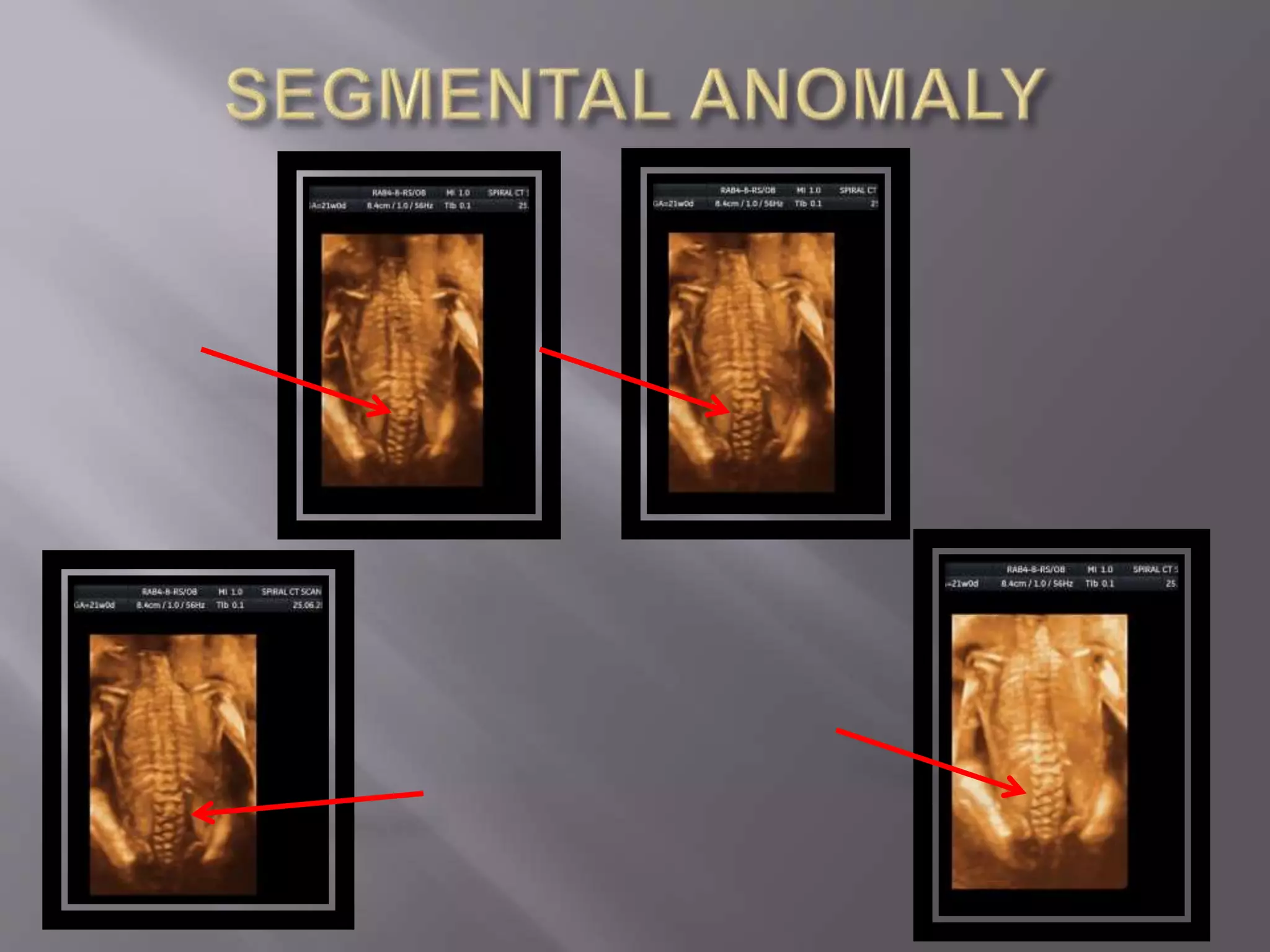 Advanced usg lounge 3 d image gallery