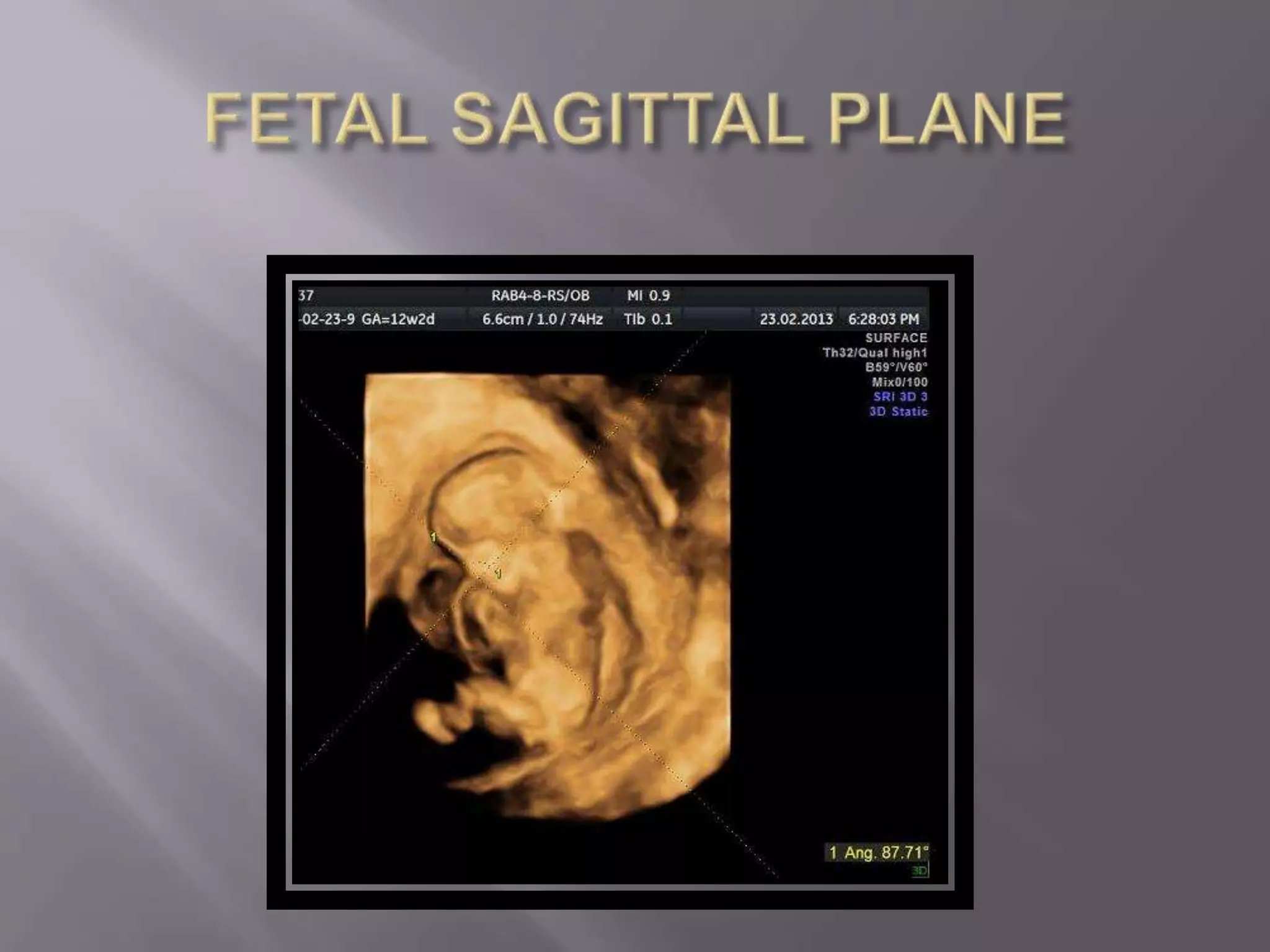 Advanced usg lounge 3 d image gallery