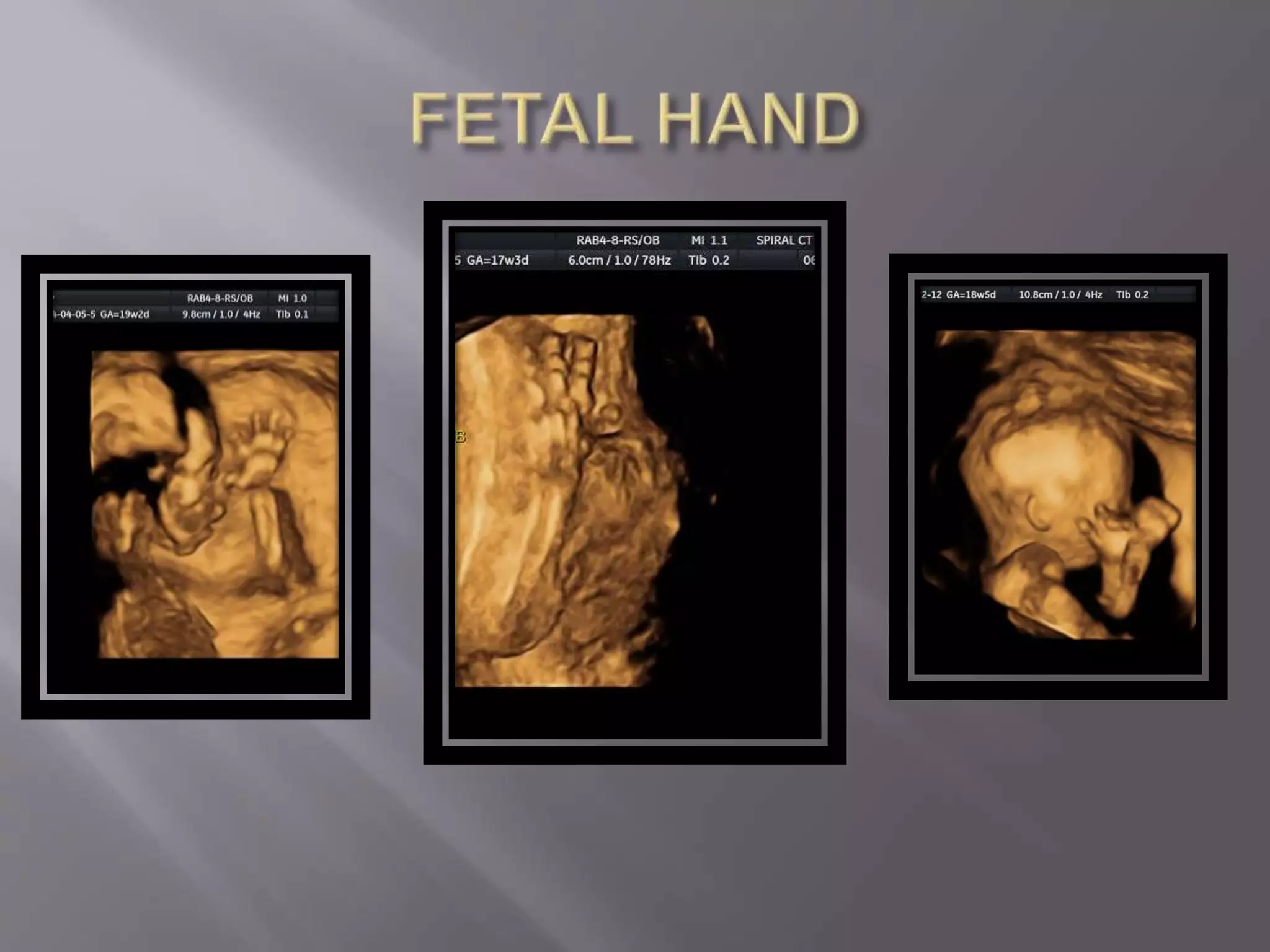 Advanced usg lounge 3 d image gallery