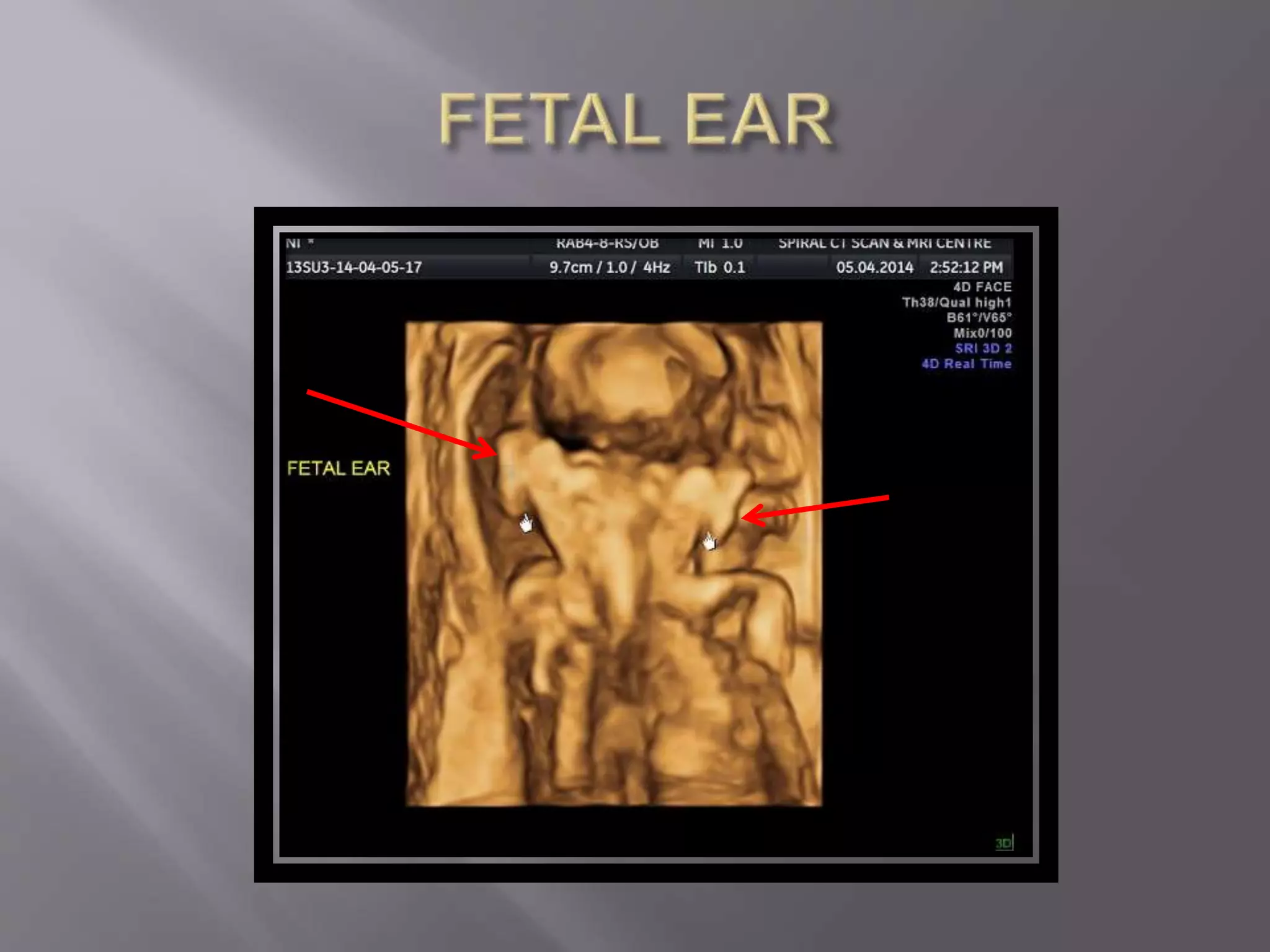 Advanced usg lounge 3 d image gallery