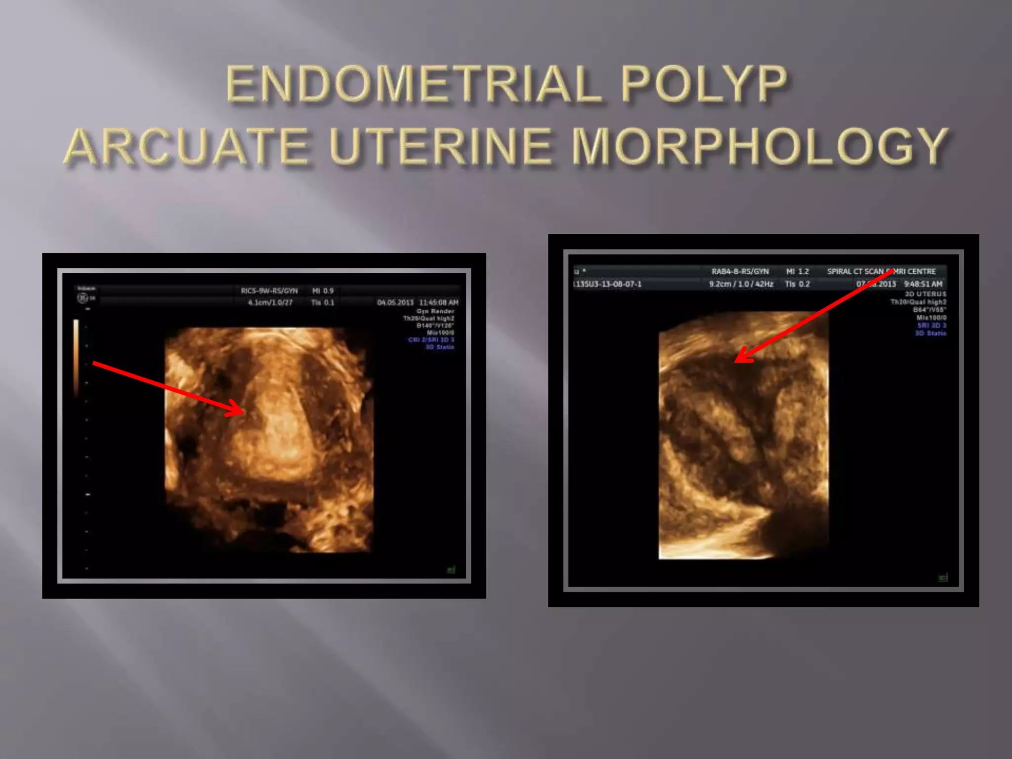 Advanced usg lounge 3 d image gallery