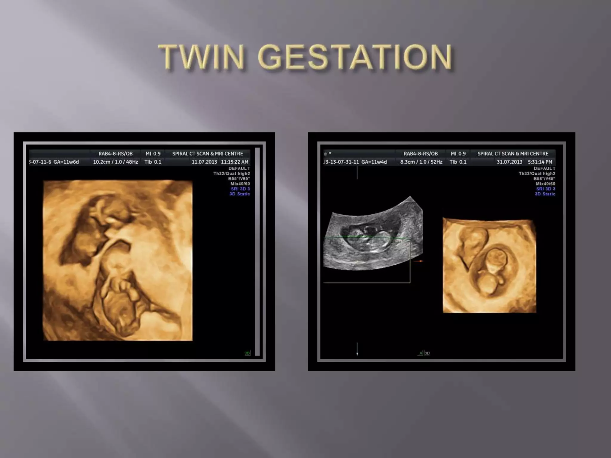 Advanced usg lounge 3 d image gallery