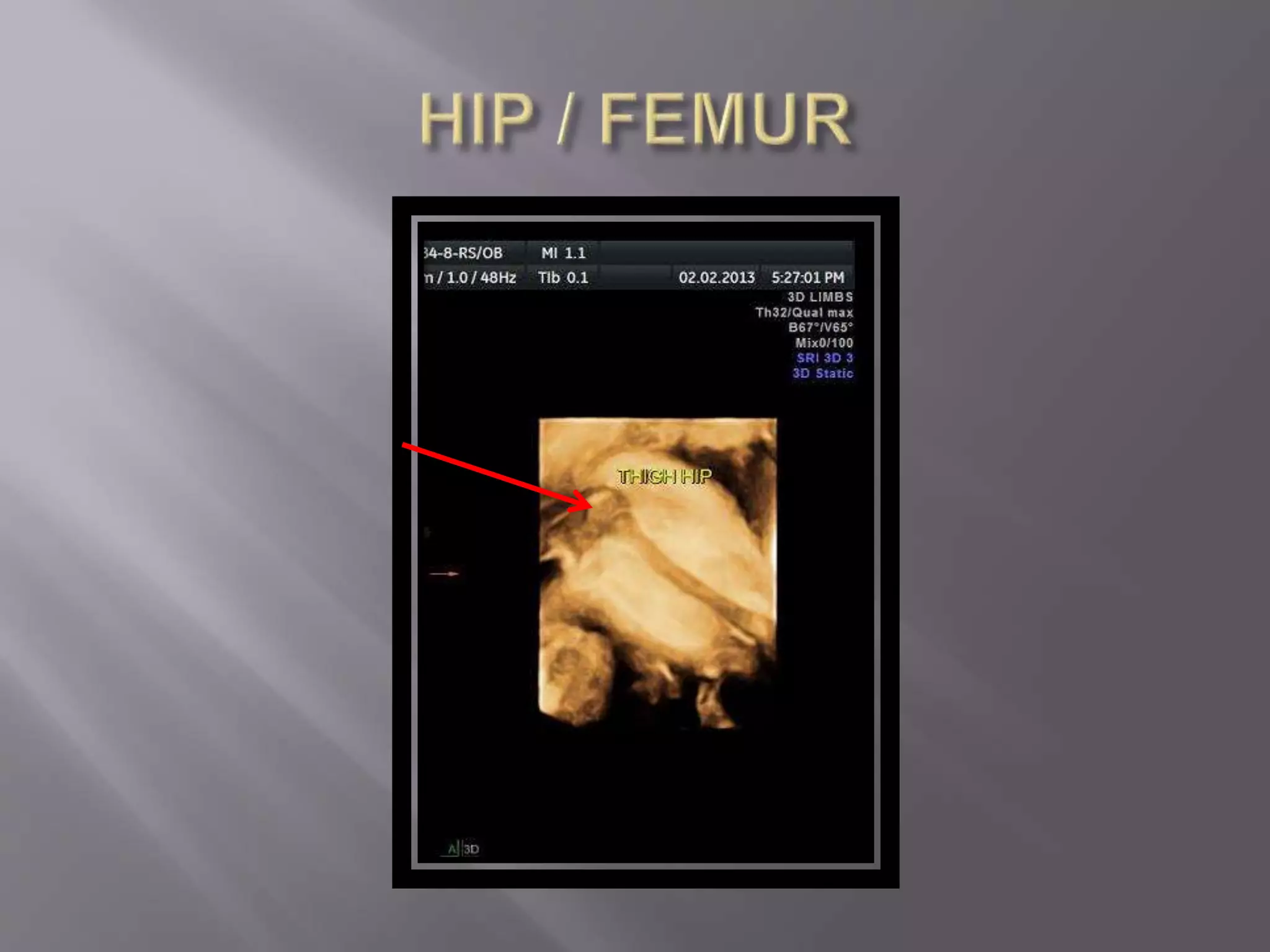 Advanced usg lounge 3 d image gallery