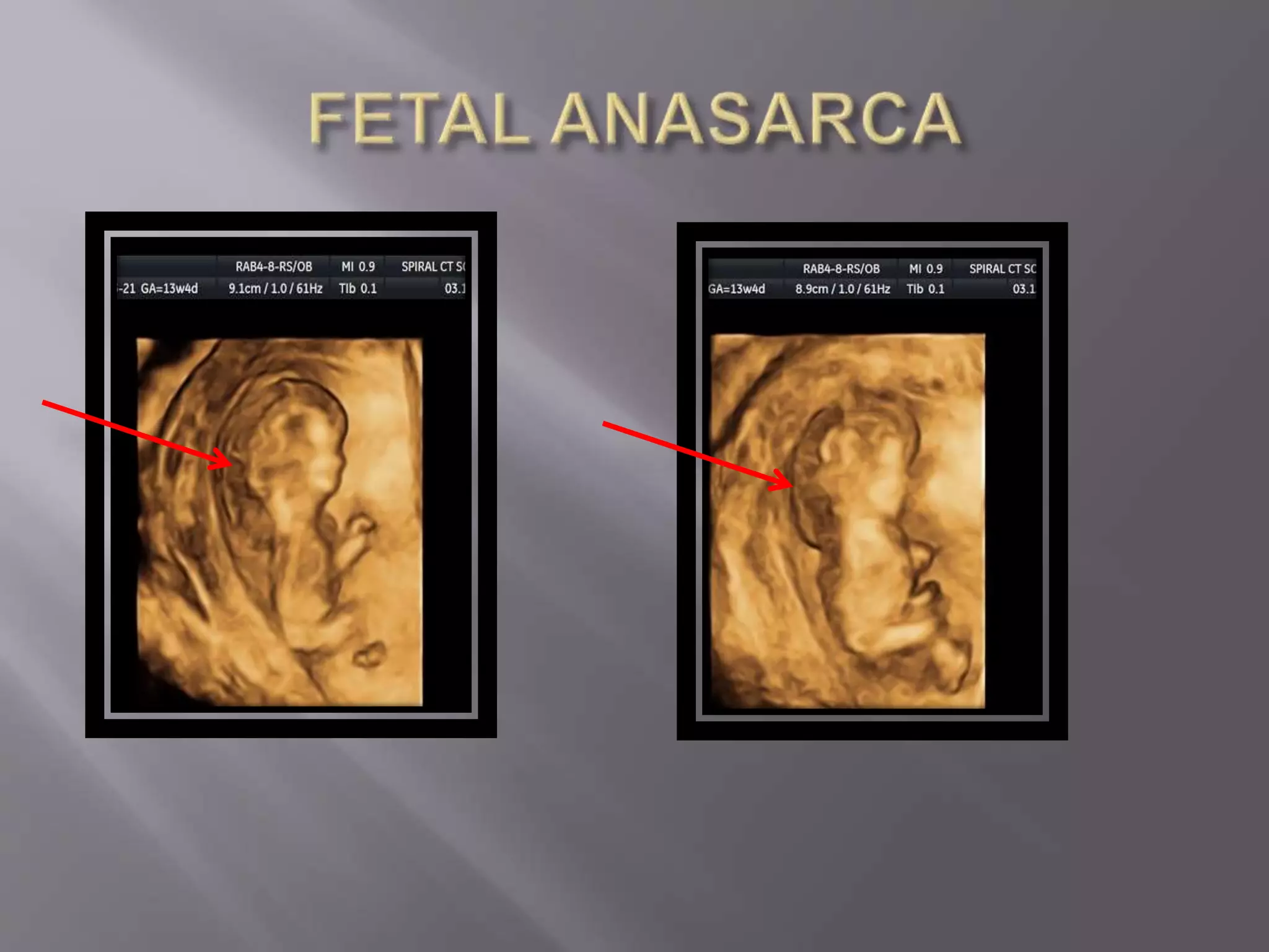 Advanced usg lounge 3 d image gallery