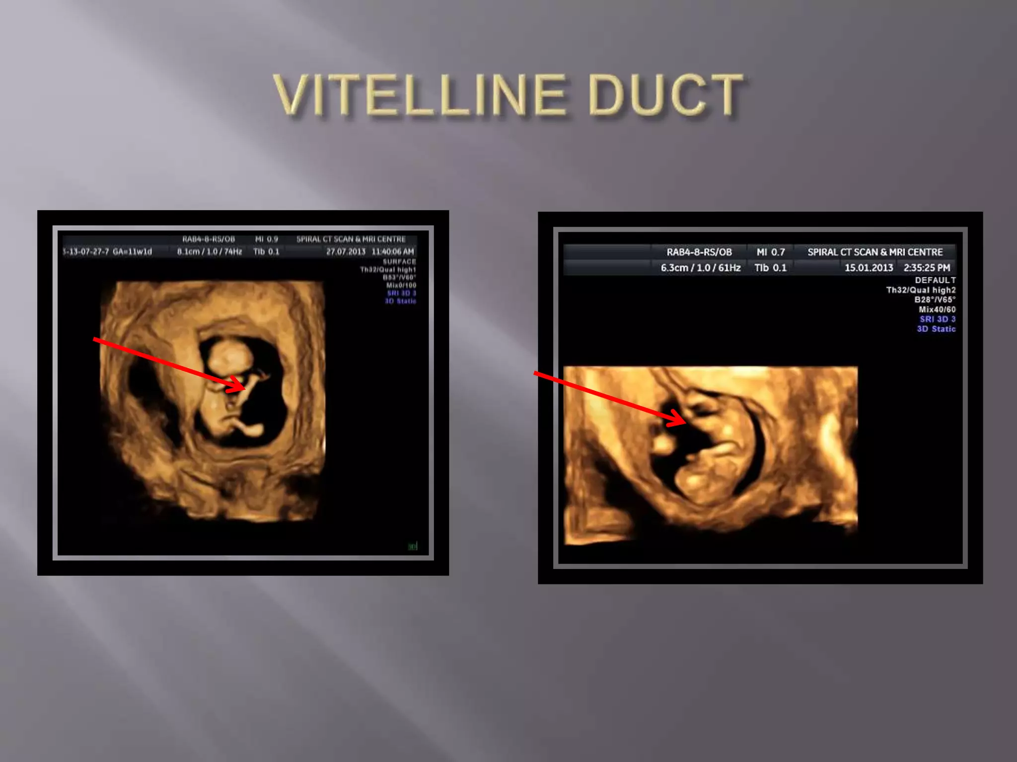 Advanced usg lounge 3 d image gallery