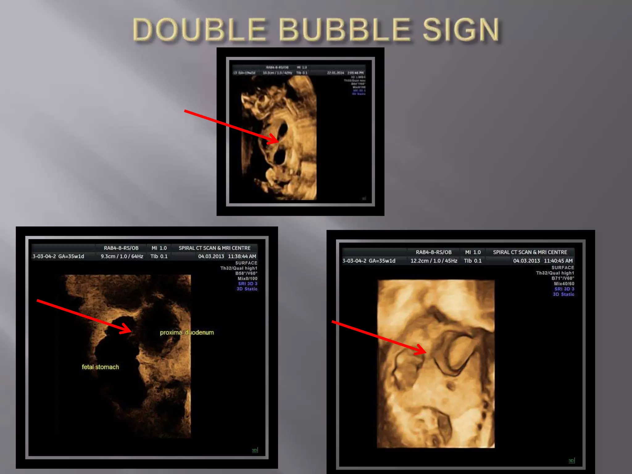 Advanced usg lounge 3 d image gallery