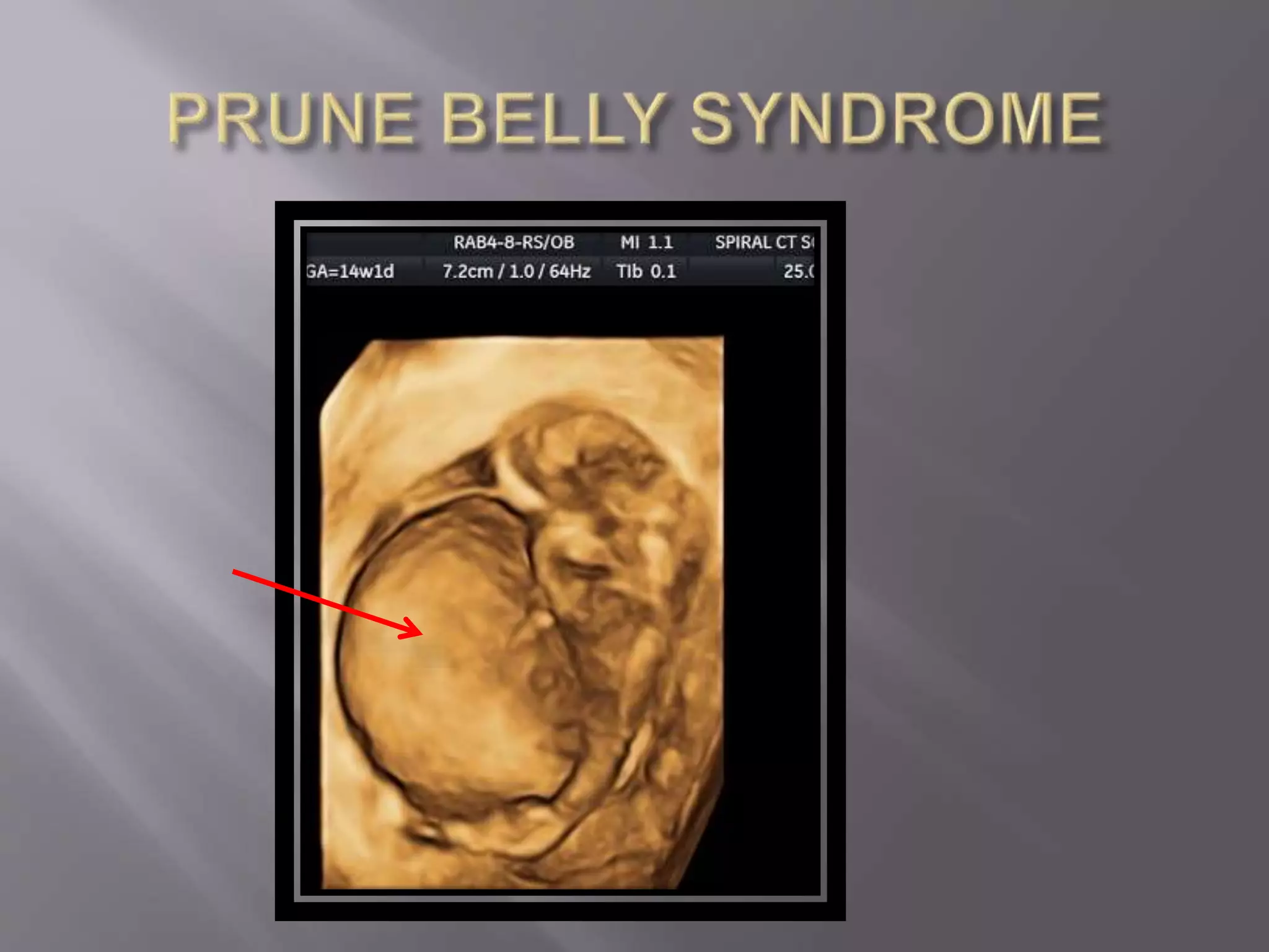 Advanced usg lounge 3 d image gallery