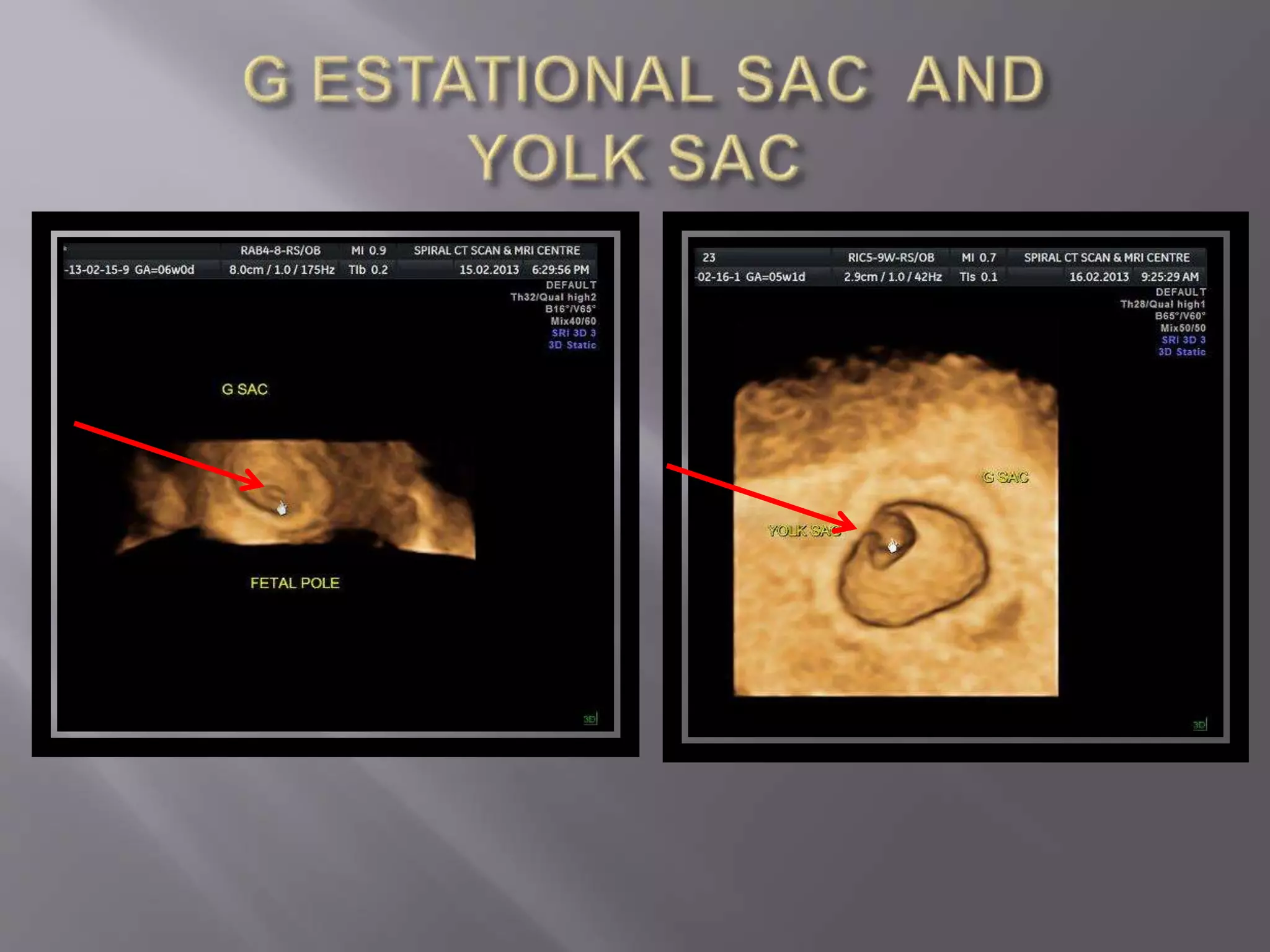 Advanced usg lounge 3 d image gallery