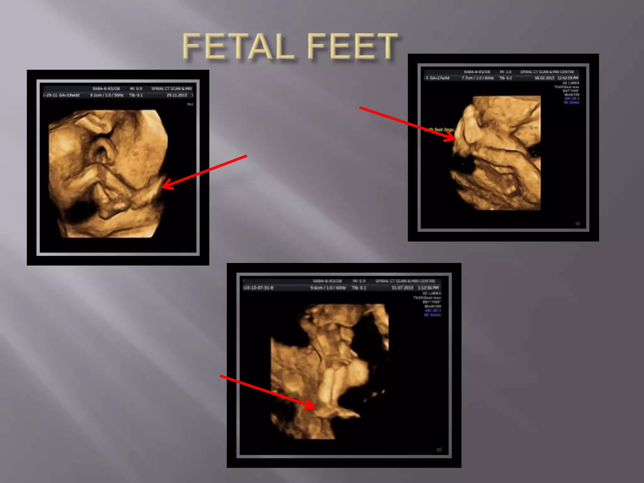 Advanced usg lounge 3 d image gallery