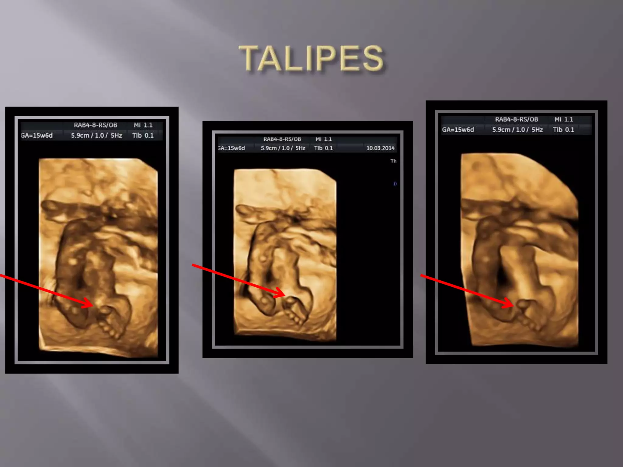 Advanced usg lounge 3 d image gallery