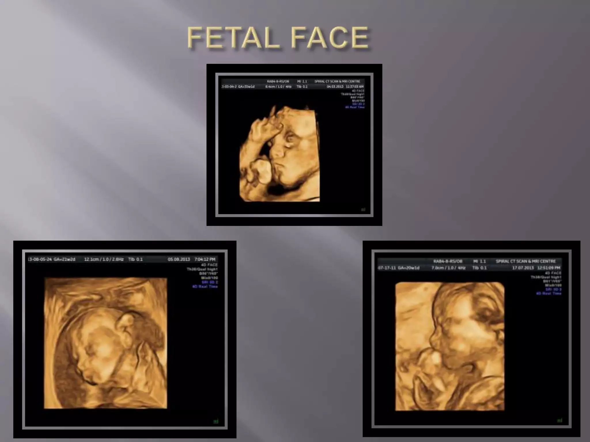 Advanced usg lounge 3 d image gallery