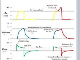 PPawaw
cmHcmH2200
6060
-20-20
6060
FlowFlow
L/minL/min
VolumeVolume
Set flow
Set tidal volume cycle threshold
Set pressure limit
Tidal volume
met
Tidal volume
not met
Switch from Pressure control to
Volume/flow control
Inspiratory flow
greater than set flow
Flow cycle
Inspiratory flow
equals set flow
Pressure limit
overridden
LL
0
0.6
4040
 