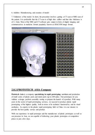 14
6. Additive Manufacturing and creation of model
7. Validation of the model. In short, the procedure involves getting a CT scan or MRI scan of
the patient. It is preferable that the CT scan is of high slice caliber and that slice thickness is
of 1- 2mm. Most of the MRI and CT software give output in form of digital imaging and
communication in medicine format popularly known as DIACOM image format.
2.8.3.PROTOTECH ASIA Company
Prototech Asia is a company specialising in rapid prototyping services and production
of small series of plastic parts and metal parts (up to 200 units). Our prototypes let you
validate a design, perform assembly testing or prepare the launch of a product. With many
years in the sector of rapid prototyping services, we succeed to produce plastic rapid
prototyping of the highest quality, both in terms of its technical functionality and its visual
aesthetics. As experts in the plastic rapid prototyping field in China it is our mission to
provide the best quality service and product.
With our experience in rapid prototype and the manufacture of plastic prototypes as well as
our presence in Asia, we are capable of delivering your plastic prototypes at competitive
prices in just a few days.
 